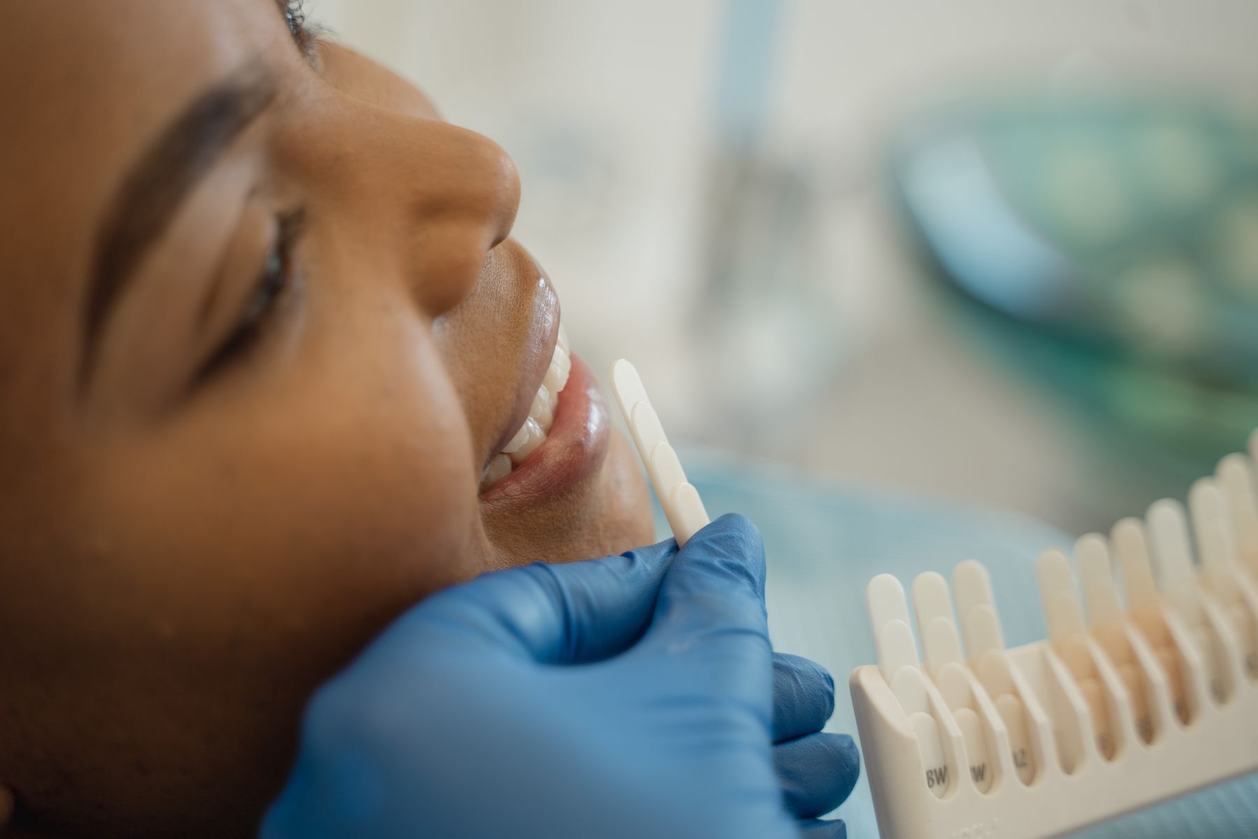 A relaxed patient smiling while her tooth shade is matched at Pearl Dental Studio